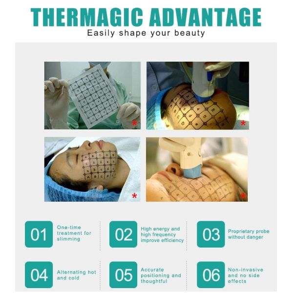 Thermagic Rf Body Slimming 9d Hifu Machine