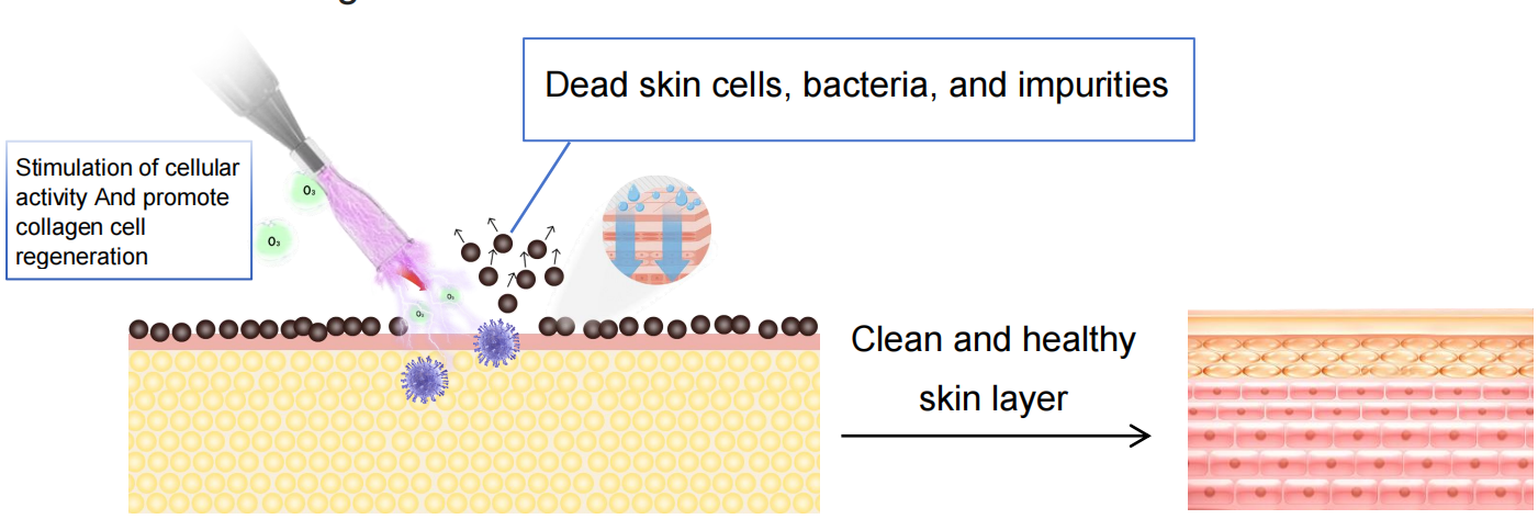Cold Plasma Acne Spot Scar Wrinkle Removal Jet Plasma Beam Skin Rejuvenation
