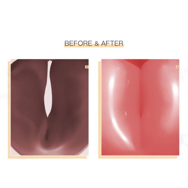 PH Balanced Vaginal Lactic Acid Suppositories Inhibits Pathogenic Bacteria Custom