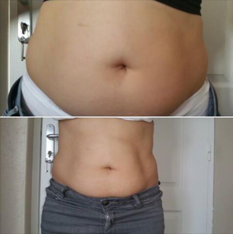 Spa Slimming Machine Cryo + Cavitation + RF Machine Skin Tighten Treatment