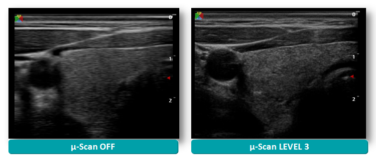 Trolley 4d Color Doppler Ultrasound Ecografo Sonoscape S50 Ultrasound