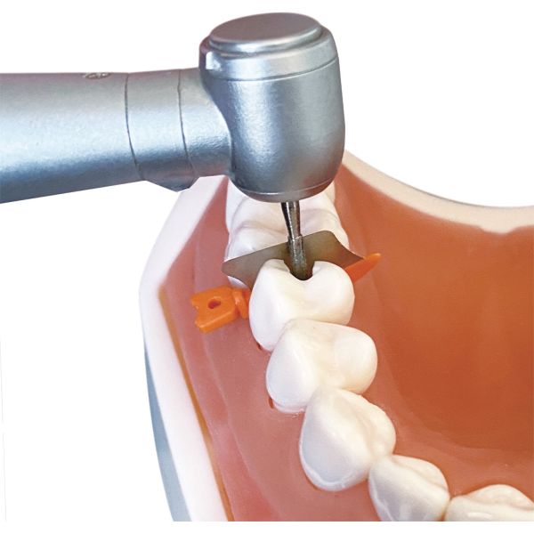 Dental Sectional Matrix System Wedge Guards M3 3.0