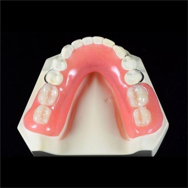 Custom Made Acrylic Removable Partial Denture Single Tooth