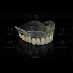 Removable Dentures
