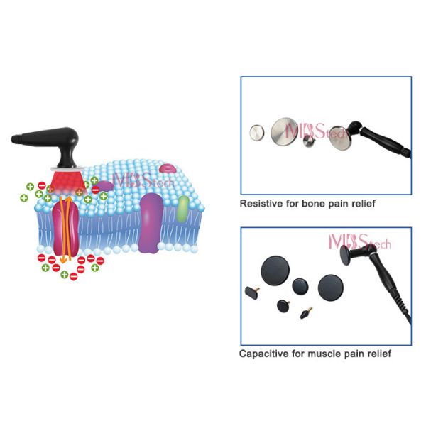 Оборудование Tecar 8,0 физиотерапии терапией Diatermia  для сброса боли в спине