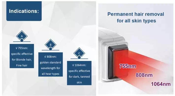 PZ Laser 2500W 755nm+808nm+1064nm painless depilación láser equipment for female