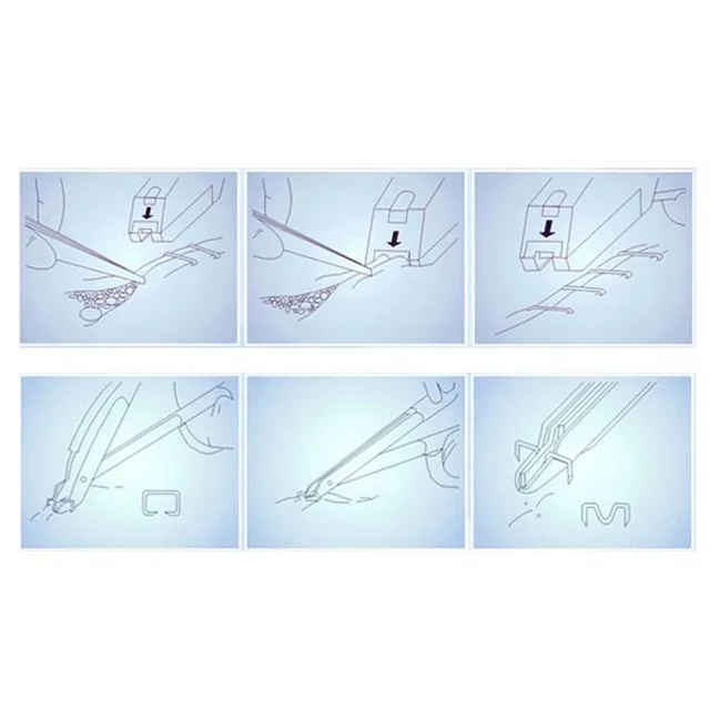 Flexible Medical Stitching Surgical Skin Stapler Advice 45W