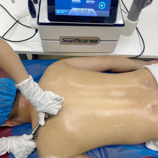 Acoustic Electric Tecar ShockWave Diathermy Machine Muscle Stimulation