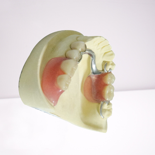 Dentures профессиональных зубоврачебных продуктов лаборатории акриловые съемные частично