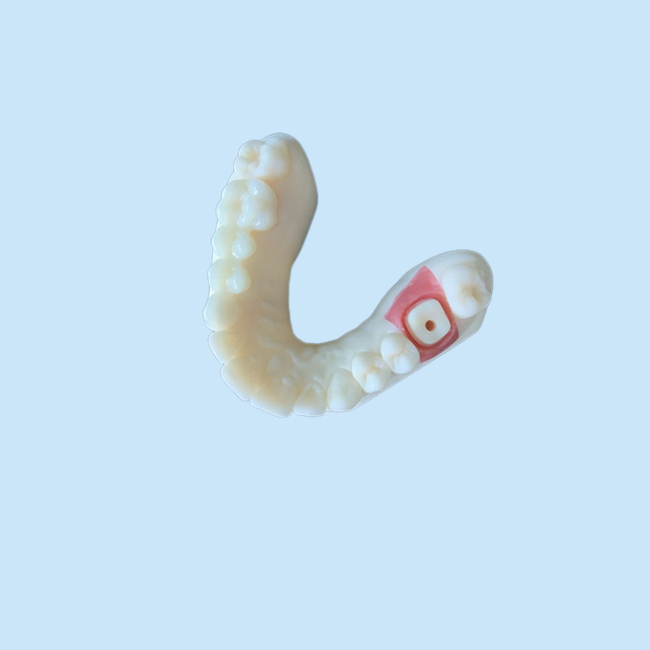 Высокий зуб кроны Zirconia стабильности PFM пятнает устойчивый для исследования
