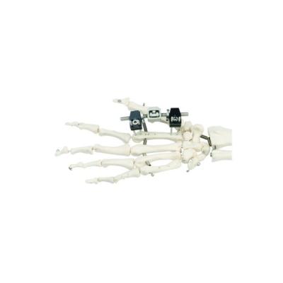 Preço de fábrica Mini Fragment Orthopedic Orthofix External Fixator com os pinos para o dedo