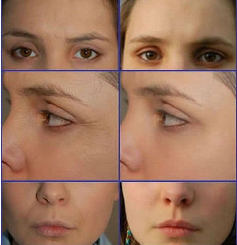 2016 OPT professional portable hair removal Skin rejuvenating IPL laser machine beauty equipment