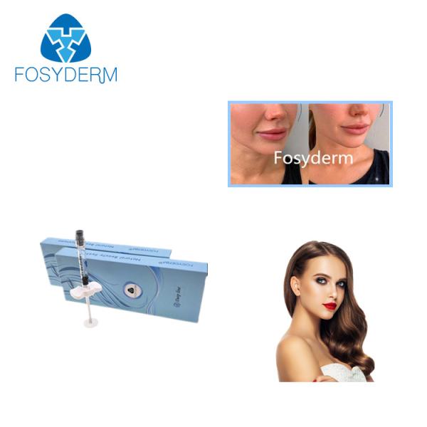 Linha profunda enchimentos cutâneos à base de ácido hialurónicos de Fosyderm 2ml