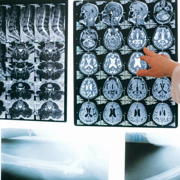 Inkjet Blue Medical Dry Film Transparent Blue Xray Film For CT DR MRI Radiological Device