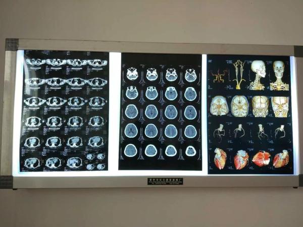 Waterproof X Ray Dry Film Imaging For Medial Devices Laser Inkjet Printing