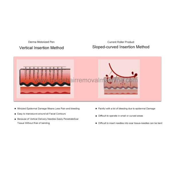 Commercial Micro Derma Pen Automatic Micro Needle Therapy System With Needle Cartridge