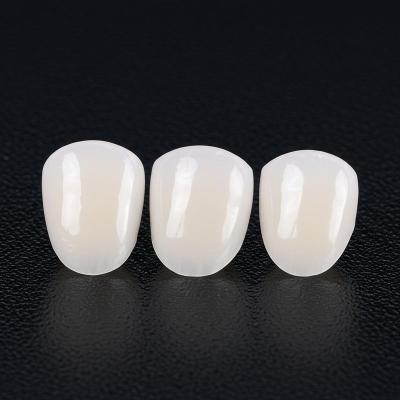 High Translucency Porcelain Dental Veneers with 0.3-0.5mm Thickness and 16 Shades Color Options