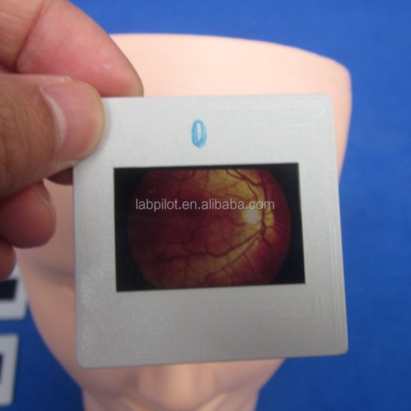 Manikin for Advanced Human Eye Examination Training Simulator Retinopathy Fundus Model
