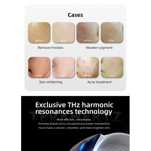 Salón de belleza PDT Máquina LED PDT de espectro múltiple Dispositivo de terapia de luz para el rejuvenecimiento de la piel