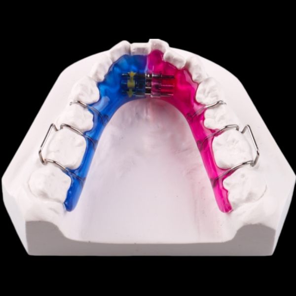 Removable Bidirectional Teeth Palate Expander Orthodontics Appliance