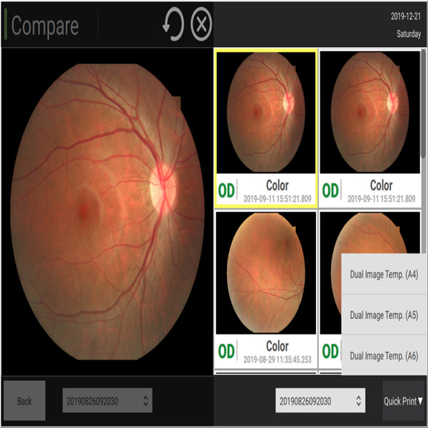 Двойник ставит точки вспомогательная автоматическая камера 60 Lp/Mm Fundus воображения цифров ретинального