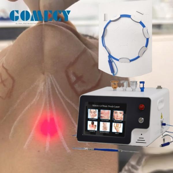 Machine à laser à double menton 1470nm Endolift avec un modèle de balayage de 5mW