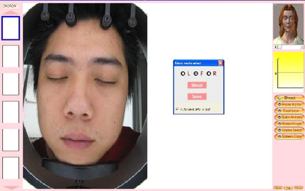 Hot sale intelligent skin analyzer machine with high resolution