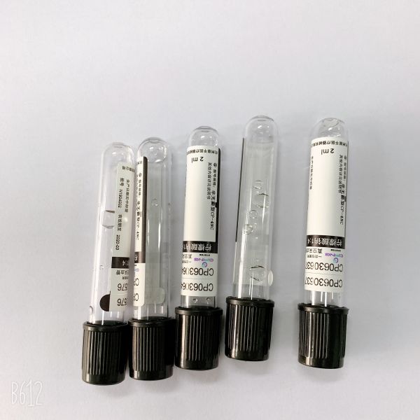 1:4 цитрата Одюм трубки 2мл ЭСР для ассоциации всей крови европейской ренальной