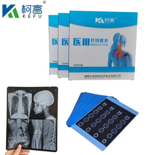 Película médica para rayos X 8*10in*25cm Para FUJI Película médica para rayos X