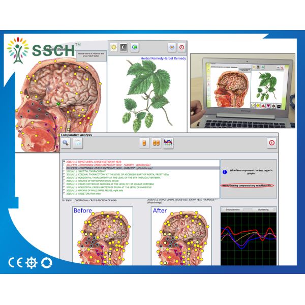 SSCH Hunter 4025 Metatron NLS System 18D NLS Clinical 11 Languages 1 Year Warrenty