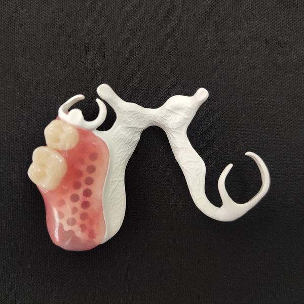 Peek Material Removable Dentures Customized 3D Laser Printing for Natural Fit