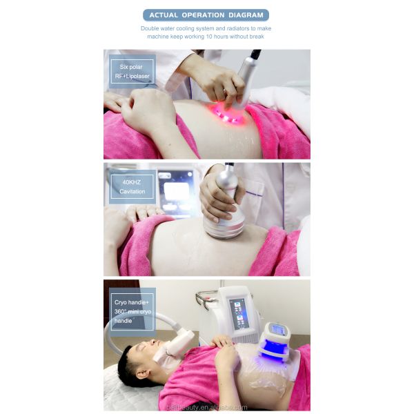 Multifunctional Vacuum Cavitation System With 4 Cryo Handles RF Fat Burning Machine