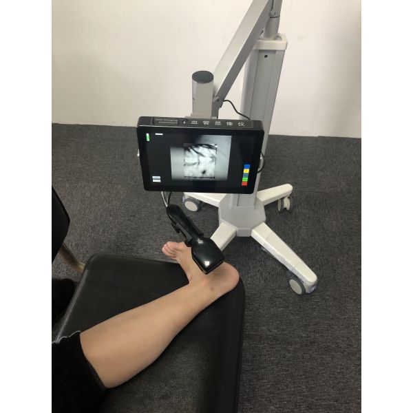 Точность < вена искателя вены медицинского васкулярного Имагер 0.2мм ультракрасная обнаруженная для брюзгливых достигших возраста пациентов