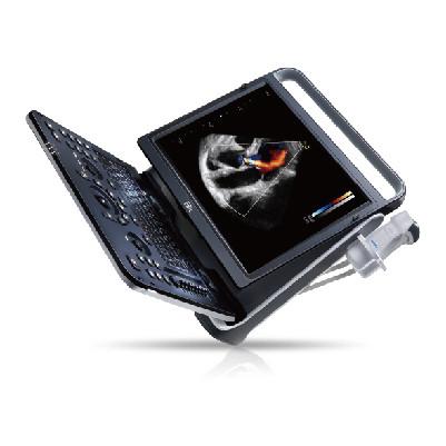 128 Element Wifi Ultrasound Chison EBit 60 For Cardiovascular