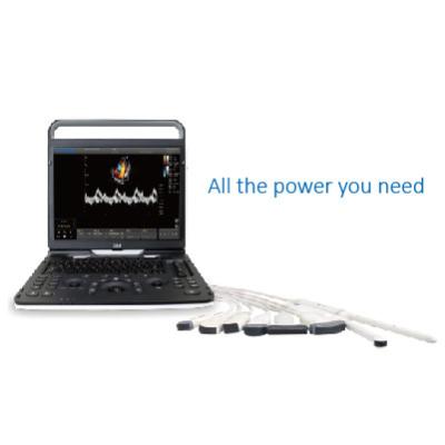128 Element Wifi Ultrasound Chison EBit 60 For Cardiovascular