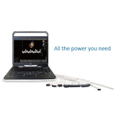 128 Element Wifi Ultrasound Chison EBit 60 For Cardiovascular