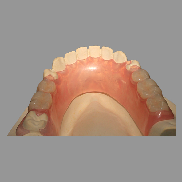 Dental Lab Crown |  Casting Pink TCS Flexible Partials With Excellent Retention