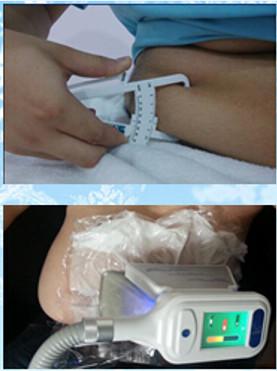 2018 Super Semiconductor Cooling -15℃ Fat Freeze Cryolipolysis Beauty Equipment