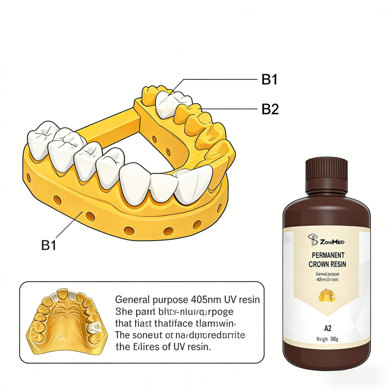 Permanent Crown Bridge Resin Featuring BL A2 A3 5 A1 A3 Shades Shelf Life 3 Years Durable Permanent Crown Resin Material