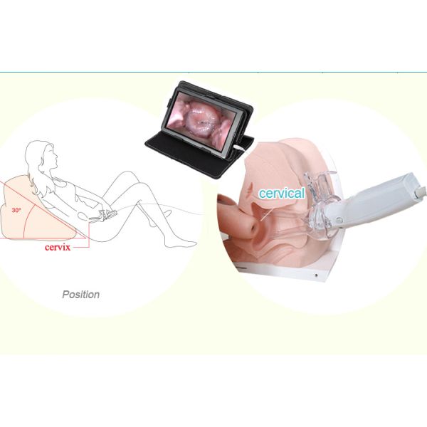 Колпоскопе цифров видео- для шейки матки Инспктион влагалища с камерой 7 дюймов медицинской профессиональной