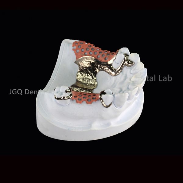 3D Printing Titanium Dental Framework for Customized Removable Dentures