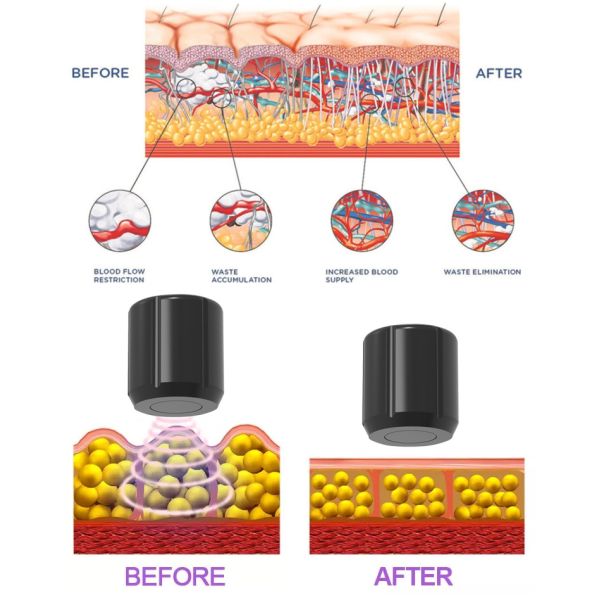 Не инвазионное проектирование -5℃ замерзая машины Cryolipolysis жирное человеческое