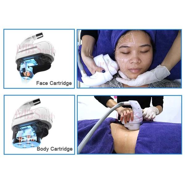 Охлаждая машина подниматься стороны ЛЬДА 5D HIFU водяного охлаждения кожи