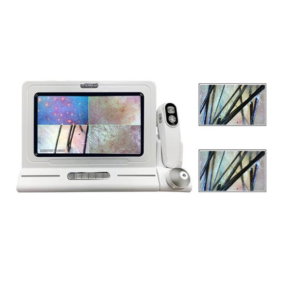 ABS PC 15 Inch HD Screen 200X Camera USB Digital Hair And Skin Analyzer
