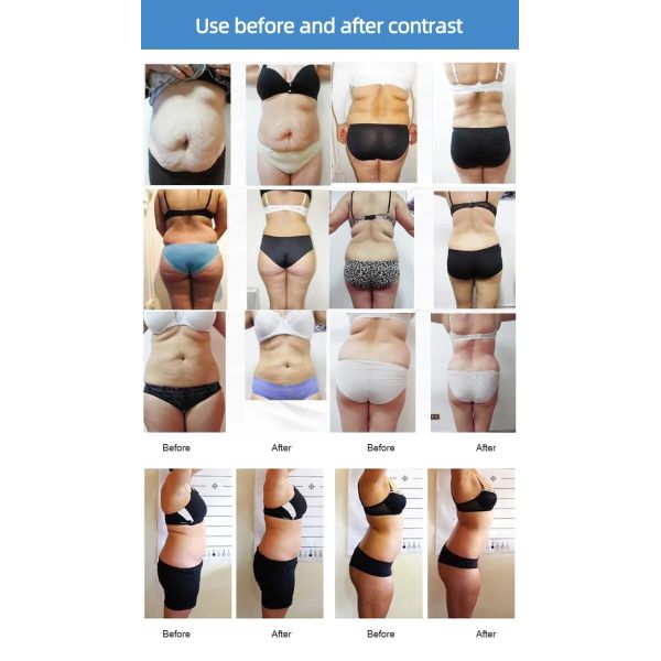 940nm 635nm Lipo Laser Slimming Machine For Weight Loss / Pain Therapy