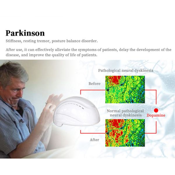 Brain Injury Health Analyzer Machine Physical Therapy Devices NIR 810nm Wavelength