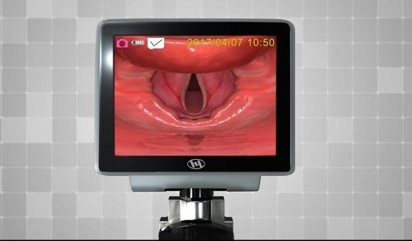HYHJ 1320 Metal Plastic Fiber Optic Video Laryngoscope With Disposable Blades