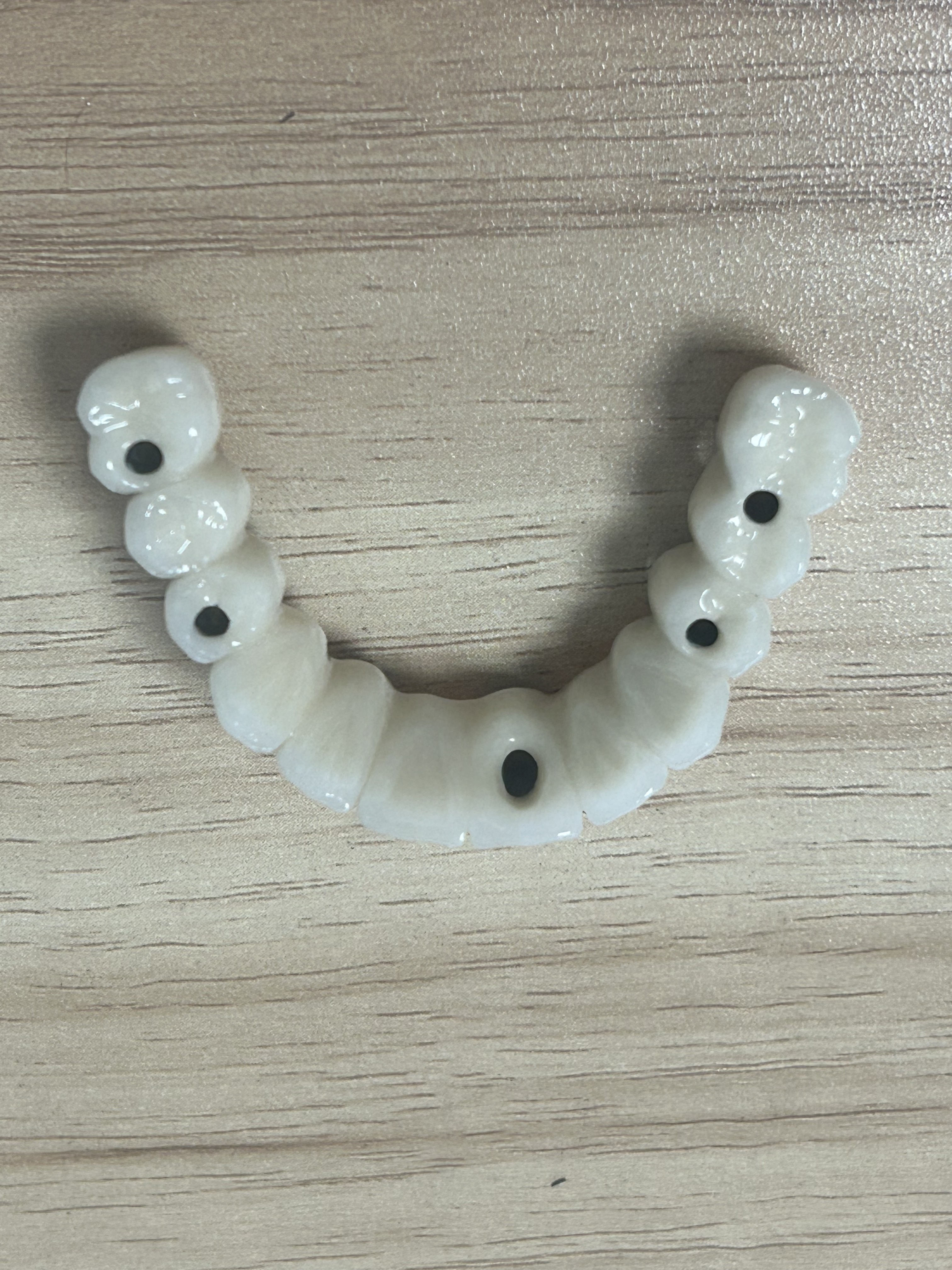 High-Strength Dental Zirconia Implant Crown with Natural Translucency & Tooth-Like Appearance via Digital CAD/CAM