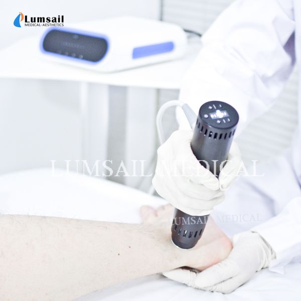 Achilles Tendinopathy ESWT Shockwave Therapy Machine