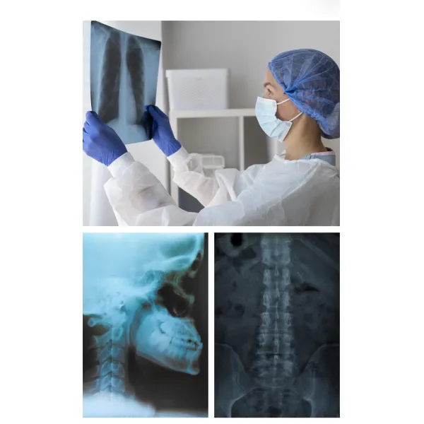 FUJI Drypix 4000/6000/8000/ Умный с помощью лазерной медицинской рентгеновской пленки 14x17 дюймов